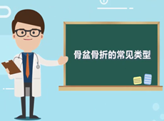 【醫(yī)療科普】骨盆骨折的常見類型有哪幾種？