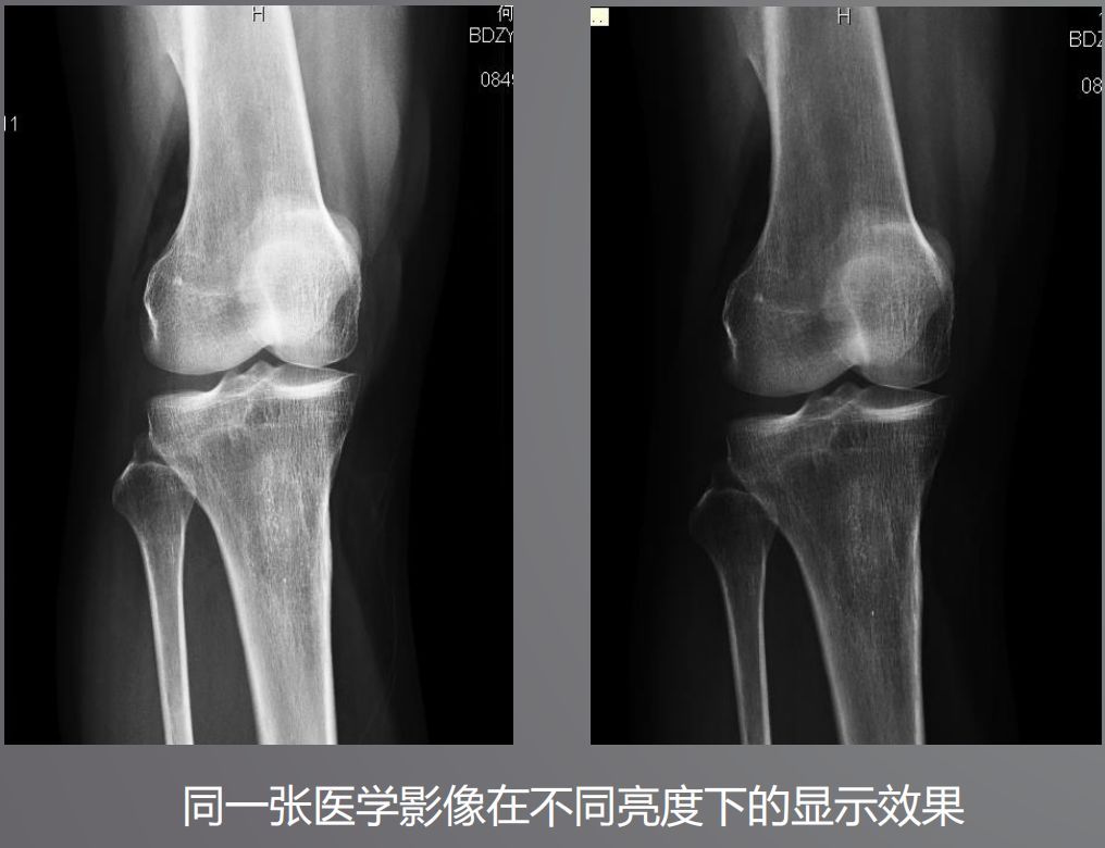 寵物DR設(shè)備的顯示器有要求？普通和醫(yī)用顯示器有什么區(qū)別